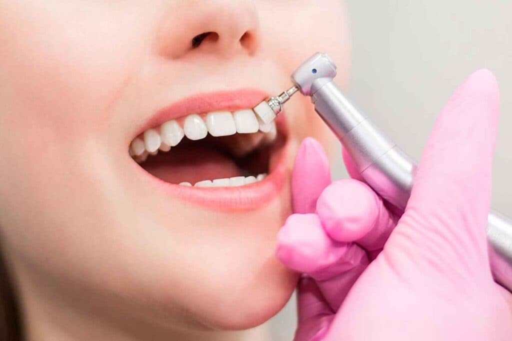 ¿Por qué es importante la limpieza dental cada 6 meses?